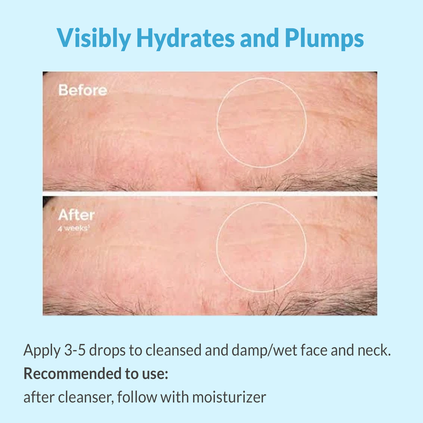 Hyaluronic Acid Serum (30 ML)